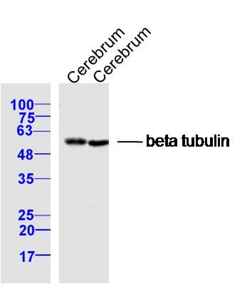bs-4511R，bioss，微管蛋白β tubulin/Tubulin β（内参）抗体 Beta tubulin(Loading Control)