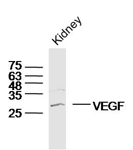 bs-1313R，bioss，血管内皮生长因子抗体 VEGF
