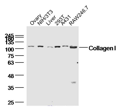 bs-10423R，bioss，I型胶原蛋白/胶原蛋白1/1型胶原蛋白/I型胶原a1抗体 Collagen I