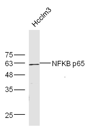 bs-0465R，bioss，细胞核因子/k基因结合核因子抗体 NFKB p65
