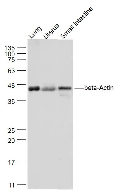 bs-0061R，bioss，β-肌动蛋白/β-Actin（内参）抗体 beta-Actin (Loading Control)